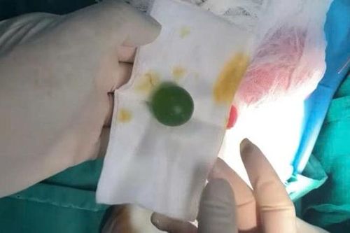 Bé 13 tháng liên tục nôn ói không rõ lý do, sự thật khiến bác sĩ lạnh sống lưng