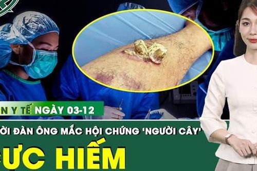 Bản tin Y tế 3/12: Người đàn ông mắc bệnh 'người cây' được phẫu thuật thoát khỏi u gai sừng