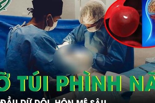 Đau đầu dữ dội, hôn mê sâu do vỡ túi phình não