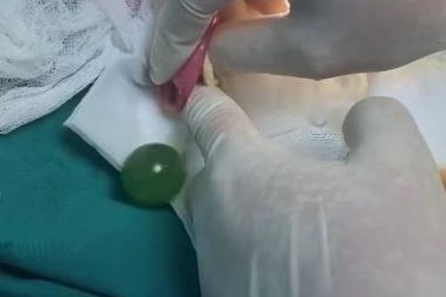Bố mẹ bất ngờ khi biết lý do khiến con trai ăn gì nôn nấy suốt 2 ngày