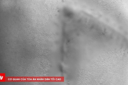 Cứu sống thiếu niên vỡ lách độ 5 sau tai nạn giao thông