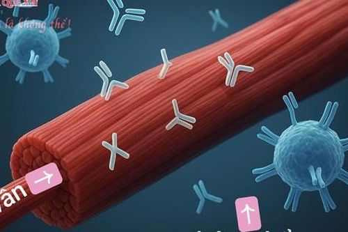 Trị liệu khai thông cột sống – hỗ trợ phục hồi cho bệnh nhân kháng thể tự miễn tiêu cơ vân