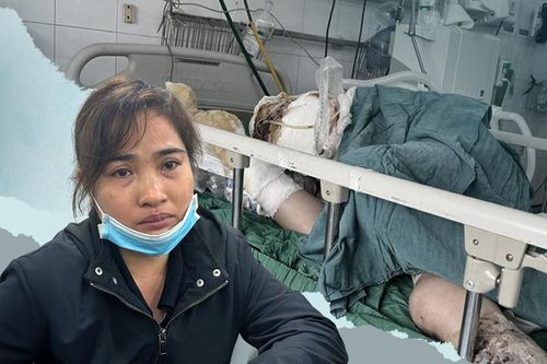 Chồng nguy kịch vì bỏng, con mắc bệnh di truyền: Vợ nghèo kiệt quệ cầu cứu
