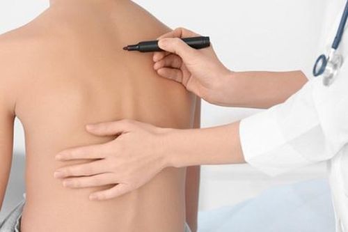 Làm gì khi trẻ gù lưng, cong vẹo cột sống do dùng điện thoại quá nhiều?