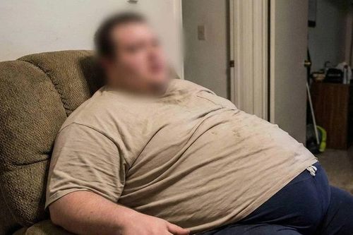 Việt Nam có tốc độ gia tăng béo phì cao nhất khu vực Đông Nam Á
