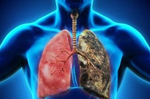 Thuốc lào là gì và có hại không?