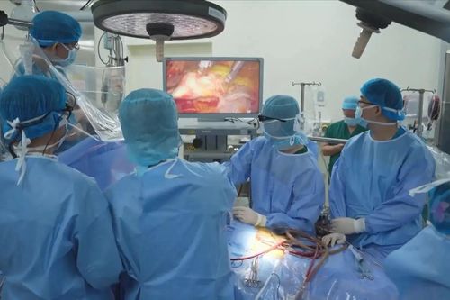 Nội soi lấy mạch trong phẫu thuật bắc cầu chủ vành
