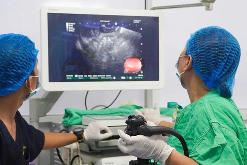 Điều trị thành công bệnh nang giả tụy bằng stent LAMS đầu tiên tại ĐBSCL