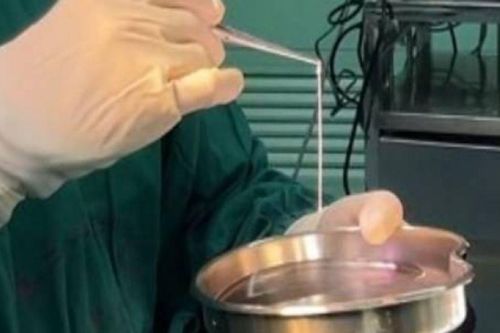Người đàn ông bị động kinh hơn 20 năm, bác sĩ bàng hoàng khi phát hiện thứ bên trong não