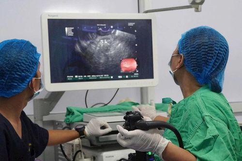 Mở ra cơ hội điều trị tiên tiến nhất cho bệnh nhân viêm tụy phức tạp bằng kỹ thuật nội soi siêu âm đặt stent LAMS