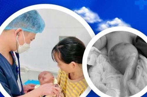 Cứu sống bé sơ sinh mắc thoát vị rốn 'khổng lồ' hiếm gặp