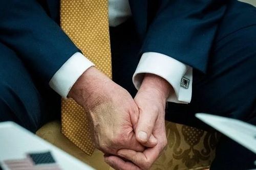Nhà Trắng nói Tổng thống Trump phải dán băng y tế vì bắt tay quá nhiều
