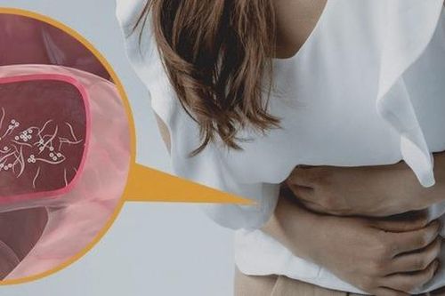 Ổ giun trong đại tràng người phụ nữ có thói quen ăn rau sống