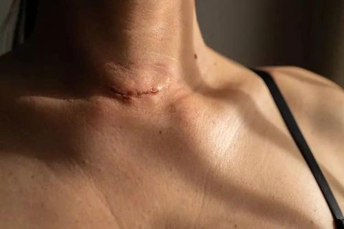 Một bệnh ung thư dẫn đầu ca mắc ở TP.HCM, chuyên gia chỉ ra lý do
