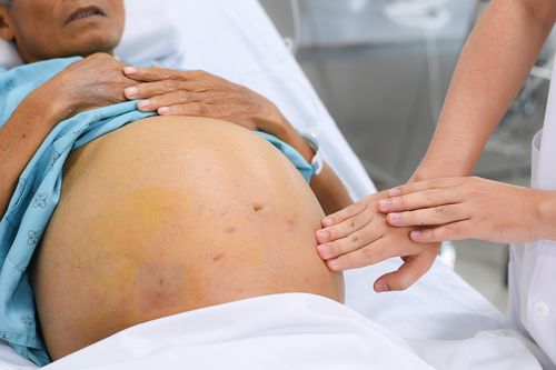 Thói quen khó bỏ của nhiều nam giới Việt khiến gan, tụy bị hủy hoại