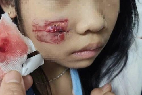 Cháu bé bị khỉ hoang tấn công khi chơi ở sân nhà
