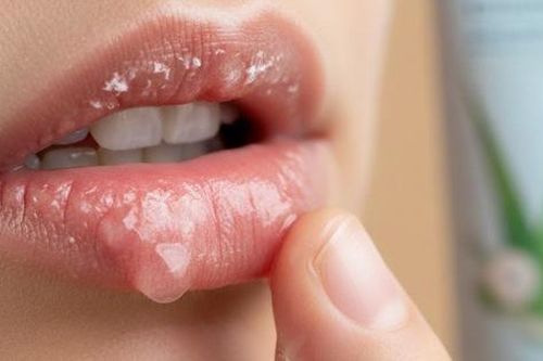 Gợi ý 8 biện pháp khắc phục tại nhà cho môi khô và nứt nẻ