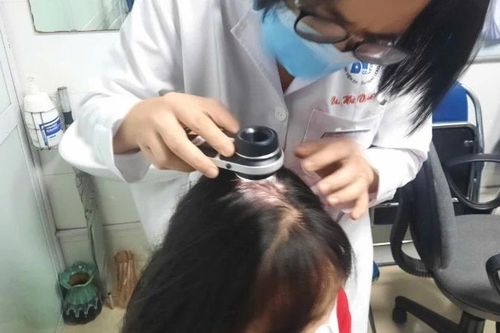 Tóc bạc sớm liệu có liên quan đến ung thư?
