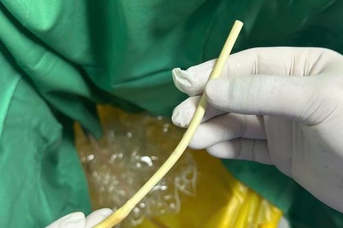Con hốt hoảng khi cụ ông cắt phăng thiết bị y tế vì 'loằng ngoằng'