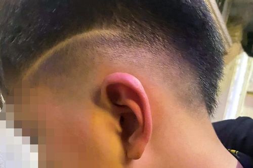 Công an vào cuộc vụ bé trai 12 tuổi ở Hà Nội nghi bị bố bạn học hành hung