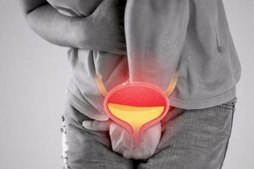 Những thói quen gây hại cho tuyến tiền liệt quý ông cần tránh