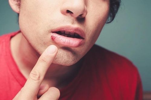 8 dấu hiệu bệnh gan biểu hiện ngay trên mặt