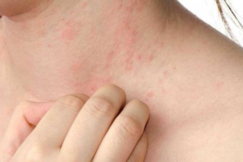 Con người có thể tiếp xúc 100.000 loại độc tố mỗi ngày