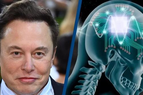 Neuralink của Elon Musk lập kỷ lục cấy chip não 1,5 giây