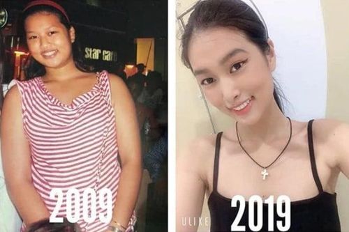Đoàn Thiên Ân lộ ảnh thời 75kg và quá khứ bị body shaming dữ dội