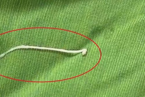 Đau bụng âm ỉ, đến viện bác sĩ gắp ra thứ 'đáng sợ' bên trong