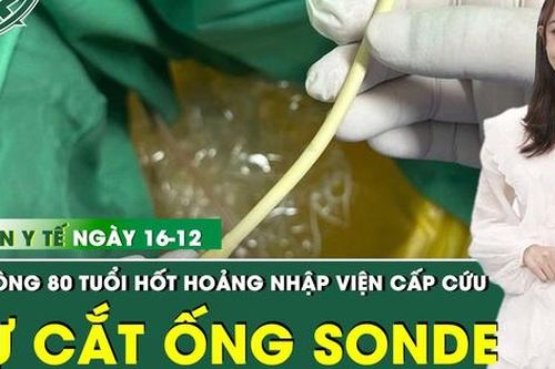 Bản tin Y tế 16/12: Cụ ông 80 tuổi tự ý cắt đứt ống thông tiểu khiến ống tụt sâu vào bàng quang