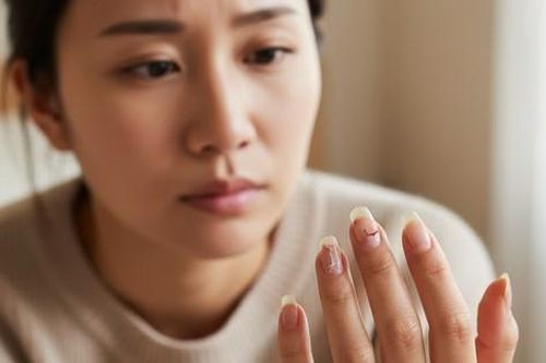 Vì sao móng tay dễ bị khô gãy khi thời tiết hanh khô? Cách chăm sóc và bảo vệ