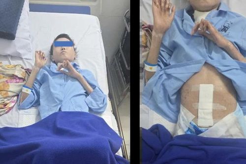 Nữ sinh 19 tuổi nguy kịch vì tổ hợp bệnh lý hiếm