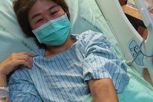 Người phụ nữ suy sụp vì tiêu chảy kéo dài suốt 3 năm, nguyên nhân không ai ngờ tới