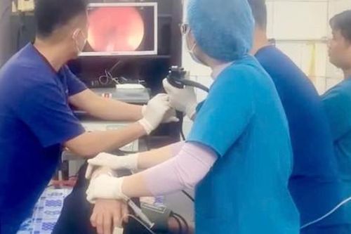 Suýt thủng thực quản vì viên thuốc