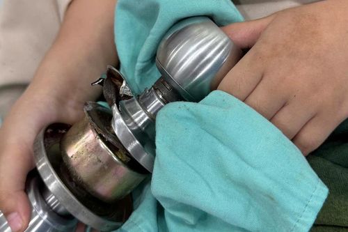 Nghịch dại, bé 5 tuổi 'ôm' ổ khóa nhập viện cấp cứu
