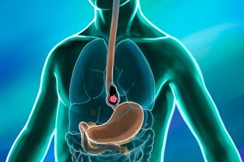 Chỉ trong buổi sáng, bệnh viện phát hiện 11 người mắc ung thư
