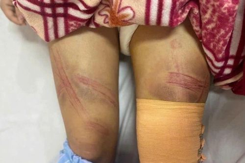 Nữ sinh lớp 7 ở Nghệ An nhập viện nghi do bị bố bạo hành