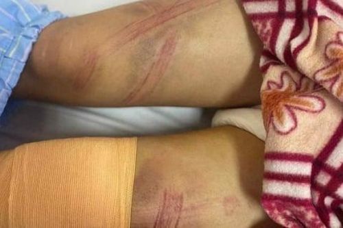 Người bố tại Nghệ An bạo hành con gái phải nhập viện