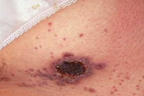 Những ca phát hiện HIV khiến bác sĩ 'giật mình'
