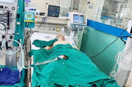 Cứu sống cụ ông 61 tuổi bị sốc nhiễm khuẩn, áp-xe phổi nguy kịch