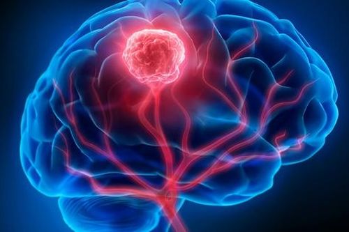Tưởng ngất do đột quỵ, người phụ nữ 36 tuổi bất ngờ phát hiện ung thư máu