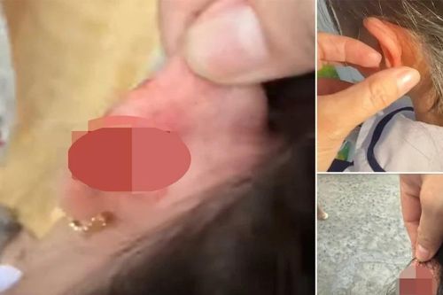 Xác minh vụ giáo viên tiểu học véo tai học sinh lớp 1 chảy máu ở Phú Quốc