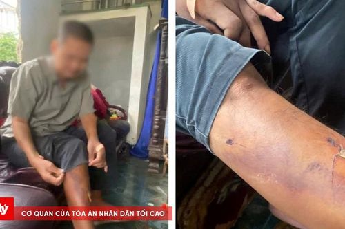 Xác định nhóm học sinh hành hung người đàn ông tại TP Huế