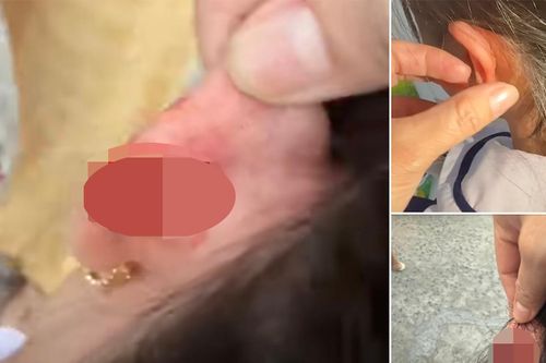 Phụ huynh 'tố' giáo viên chủ nhiệm véo chảy máu tai học sinh lớp 1