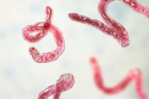 Người đàn ông 39 tuổi đột ngột phát hiện nhiễm sán não trong lần đi khám vì đau đầu