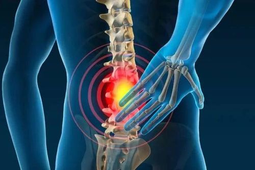 Đau lưng không ngờ phát hiện bệnh máu ác tính, đa u tủy xương