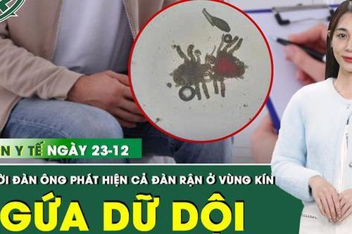Bản tin Y tế 23/12: Người đàn ông 'tá hỏa' phát hiện cả đàn rận ký sinh ở vùng kín