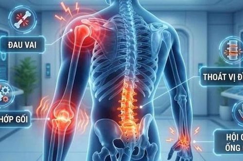 Bí kíp để hệ vận động khỏe mạnh: lời khuyên từ chuyên gia