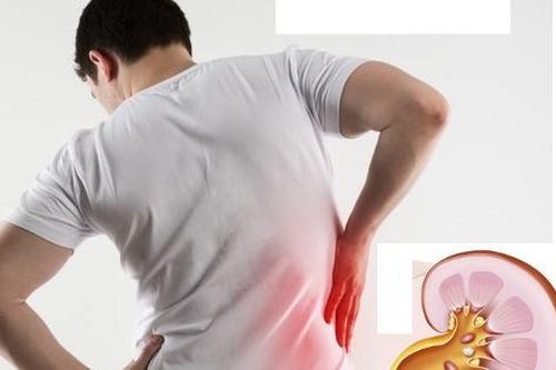 Sỏi tiết niệu có thể gây ra những hậu quả gì?